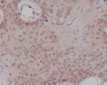ER alpha Rabbit mAb Antibody
