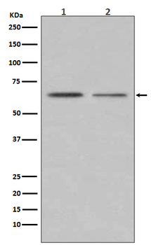 ER alpha Rabbit mAb Antibody