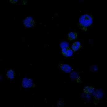 Caspase-8 Rabbit mAb Antibody