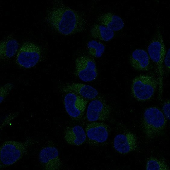 NF-κB p65 Rabbit mAb [KD Validated]