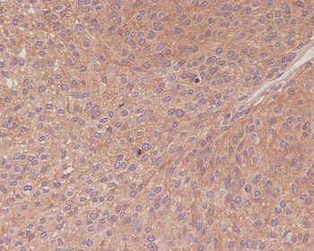 NF-κB p65 Rabbit mAb [KD Validated]