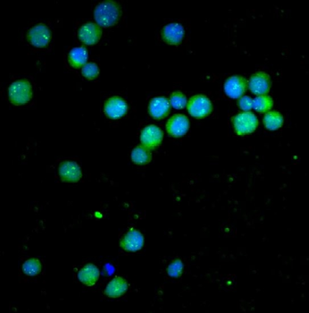 Bcl-2 Rabbit mAb Antibody