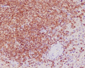 Bcl-2 Rabbit mAb Antibody