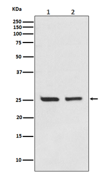 Bcl-2 Rabbit mAb Antibody