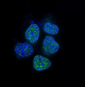 Androgen Receptor Rabbit mAb [KD Validated] Antibody