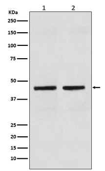 Cytokeratin 18 Rabbit mAb Antibody