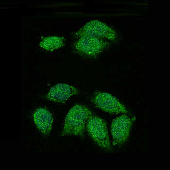 IKB alpha Rabbit mAb Antibody