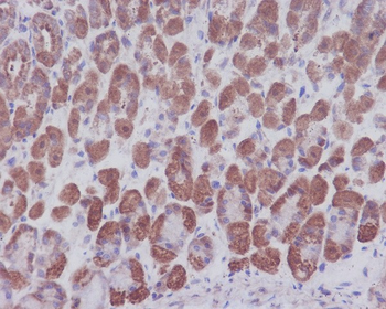 IKB alpha Rabbit mAb