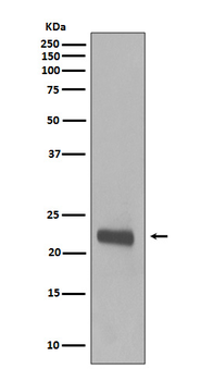 Caveolin-1 Rabbit mAb