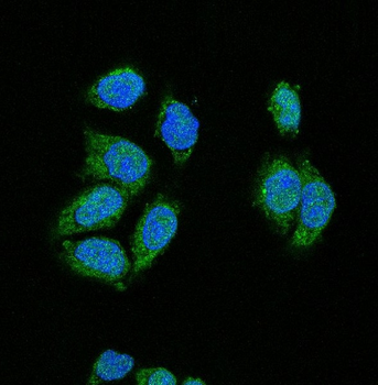 CDK2 Rabbit mAb [KD Validated]