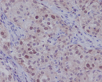 CDK2 Rabbit mAb [KD Validated]