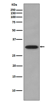 CDK2 Rabbit mAb [KD Validated]
