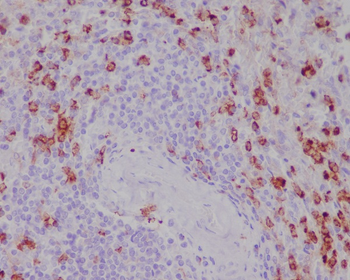 CD11b Rabbit mAb Antibody