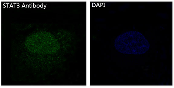 STAT3 Rabbit mAb Antibody