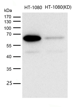 Smad4 Rabbit mAb [KD Validated]