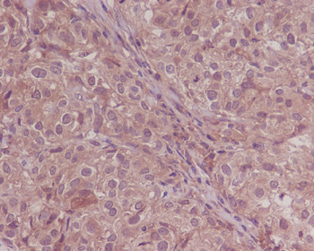 Smad4 Rabbit mAb [KD Validated]