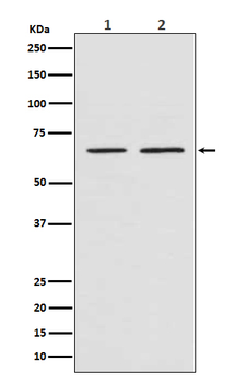 Smad4 Rabbit mAb [KD Validated]
