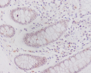Caveolin-2 Rabbit mAb Antibody