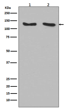 RNF20 Rabbit mAb Antibody