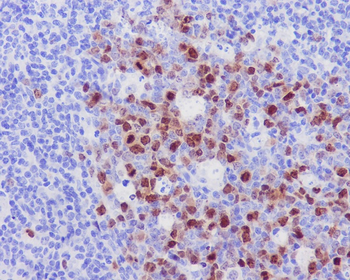 Aurora B Rabbit mAb Antibody