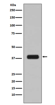 Aurora B Rabbit mAb