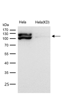 MKLP1 Rabbit mAb [KD Validated] Antibody