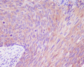 DSG1 Rabbit mAb Antibody