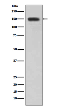 DSG1 Rabbit mAb Antibody