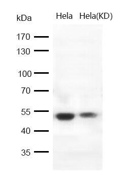 GSK3 beta Rabbit mAb [KD Validated] Antibody