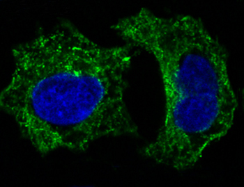 GSK3 beta Rabbit mAb [KD Validated]