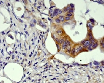 GSK3 beta Rabbit mAb [KD Validated]