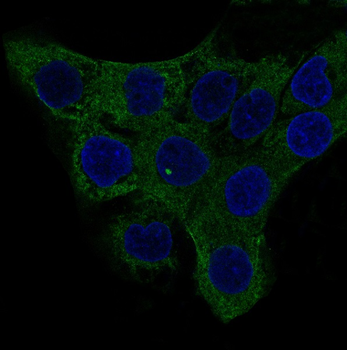 alpha smooth muscle Actin Rabbit mAb [KD Validated]