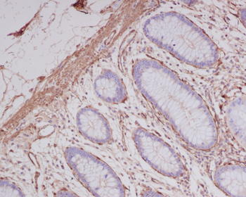 alpha smooth muscle Actin Rabbit mAb [KD Validated]