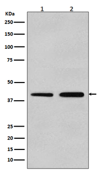 alpha smooth muscle Actin Rabbit mAb [KD Validated]