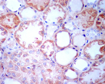 TGFBI Rabbit mAb Antibody