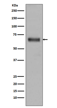 TGFBI Rabbit mAb Antibody