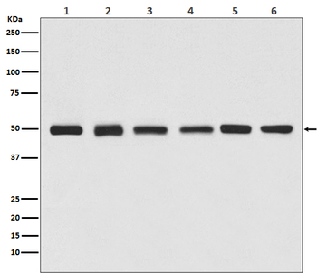 beta Tubulin Rabbit mAb (HRP conjugated) Antibody