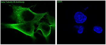 beta Tubulin Rabbit mAb Antibody