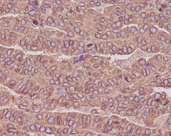 beta Tubulin Rabbit mAb Antibody