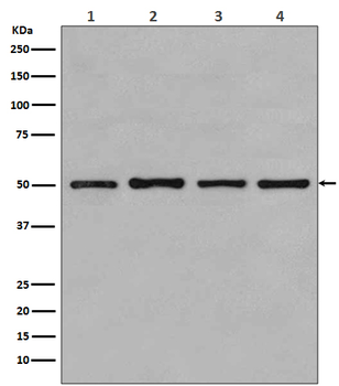 beta Tubulin Rabbit mAb Antibody