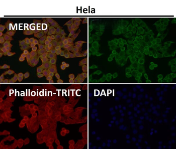 CD223 Rabbit mAb Antibody