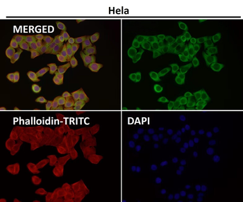 CD223 Rabbit mAb Antibody