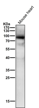 Phospho-PKC alpha (T497) Antibody