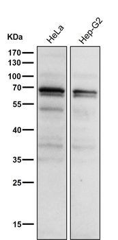Phospho-PKC alpha (T497) Antibody