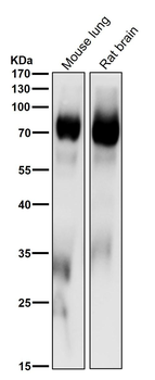 PKC delta + PKC theta Antibody