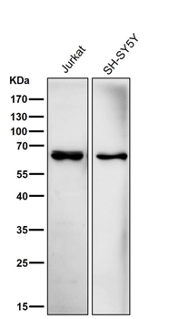 ACADVL/VLCAD Antibody