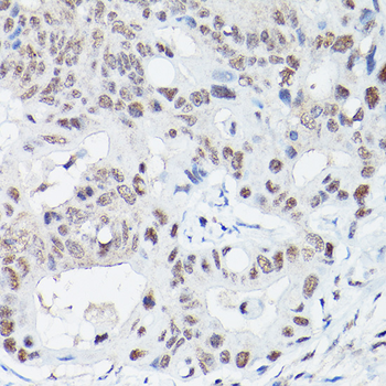DNA Ligase IV Rabbit pAb