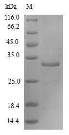 Human FOxM1 protein