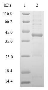 Human HLA-DRB1 protein
