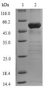 Human FBP1 protein